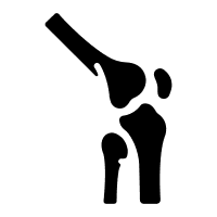 Meniscus <br/> 
Tear Treatment